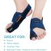 AVIDDA Bunion Corrector for Big Toe Pain Relief - Left Single Toe Straightener & Bunion Splint - Buy Online on GoSupps.com