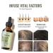 Hydront Rosemary Oil 2 Fl Oz | Paraben-Free Hair Growth & Strengthening Oil for All Hair Types - Buy Online on GoSupps.com