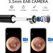Wireless 1080P FHD Ear Wax Removal Endoscope & Otoscope for iPhone, iPad & Android - Earwax Remover Tool with 6 LED Lights - Black - Buy Online on GoSupps.com
