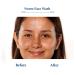 Blue Nectar Vitamin C Face Wash | Anti-Acne Neem & Honey Cleanser for All Skin Types - 3.38 Fl Oz - Buy Online on GoSupps.com