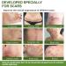 flysmus Advanced Scar Repair Serum - Medical Grade Spray for All Types of Scars (1PCS) - Buy Online on GoSupps.com