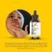 Artnaturals Lactic Acid + AHA 1 fl oz - Exfoliating Skin Treatment for Radiant Glow - Buy Online on GoSupps.com