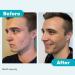 Proactiv Repair Acne Treatment - Benzoyl Peroxide Spot Treatment - 90 Day Supply - Buy Online on GoSupps.com