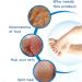 Fro e Footcare Schleifstein 4-in-1: Cornal Remover Foot Brush Pumice & Sandpaper for Pedicure Best Solution for Rough Dry Cracked Skin - Buy Online on GoSupps.com