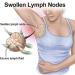 GreenHB Herbal Lymph Care Patch 10 Pcs - Neck Lymphatic Drainage Patch with Ginger Oil for Swelling & Pain Relief - Buy Online on GoSupps.com