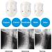 Adjustable Neckstrecker Collar - Soft Cervical Spine Traction Device for Neck Pain Relief - Breathable Neckrest (Size S) - International Shipping Available - Buy Online on GoSupps.com