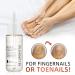 GFOUK 7 Days Nail Growth And Strengthening Serum Nail Growth and Strength Serum Nail Growth & Strengthening Oil Serum Stronger Nails in 1 Week Nail Strengthening Treatment (3 Pcs) - Buy Online on GoSupps.com