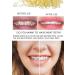 500 pcs Fox 1/4 Orthodontic Elastic Bands for Braces - Latex Rubber Bands 1/4 Inch - Buy Online on GoSupps.com
