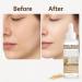 3PCS Essence Toner White Rice Ampoule Skin Softening Essence Exfoliate Face Scrub Dead Skin Fade Essence Brighten Body - Buy Online on GoSupps.com