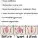 Alkyne Anniecare Instant Anti-Itch Detox Slimming & Vaginal Tightening Capsules (2 Bags) - Natural Repair Formula - Buy Online on GoSupps.com