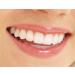 Opalescence GO 15% Whitening Kit + Bonus Mint Tooth Polish - Buy Online on GoSupps.com