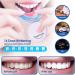 HappySmile LED & Pen Teeth Whitening Kit - Professional Oral Care for White Teeth - Includes Teeth Whitening Pen & LED for a Brighten Your Smile - Premium Teeth Whitening kit - Buy Online on GoSupps.com