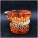 Transparent Dental Model for Adult Dentists | Realistic Teeth & Gums for Teaching & Demonstration - International Shipping - Buy Online on GoSupps.com