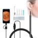 SANON Otoscope Ear Wax Remover Camera Ear Cleaner HD Visual Camera with 6 Dimmable LED Adults Kids Pets Ear Scope for Android Tablet and PC