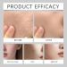 S rum PDRN ADN de Saumon Visage Ampoule Anti- ge Hydratante Raffermissante contre Rides et Ridules Essence claircissante pour Teint Irr gulier et Peau Lisse clatante 30ml (1pcs) - Buy Online on GoSupps.com
