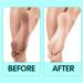 NOVAL 4-in-1 Foot Pumice Stone Set - Callus Remover & Exfoliator Tool for Pedicure (Pack of 4) - Buy Online on GoSupps.com