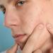 Buy Men's Anti-Acne Serum - Fast International Shipping | Clear Skin Solutions - Buy Online on GoSupps.com
