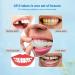 Buy 2 Pairs of Artificial Teeth & Provisional Veneers | Affordable Fake Teeth & Tooth Brightening for Men & Women - Buy Online on GoSupps.com
