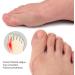10pcs Adhesive Toe Straightener Patch - Micro Elastic Cloth Wrap Brace for Soreness Reduction - Buy Online on GoSupps.com