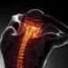 Cervical Traction Device - Inflatable Neck Collar for Home Healthcare & Spine Relief - Buy Online on GoSupps.com