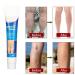 Varicose Veins Cream | Eliminate Spider Veins & Soothing Treatment - International Shipping - Buy Online on GoSupps.com