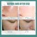 Skinferm Collagen Milk Whitening Soap Silk Protein Skin Repair Soap Exfoliating Soap Skin Whitening Soap for Face and Body (3pcs) - Buy Online on GoSupps.com