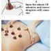 AIBYKS Moxachegen for Moxibustion | 15 Pieces Mugwort Moxa Sticks - Mini Cone Roller for Effective Moxibustion Therapy - Buy Online on GoSupps.com