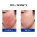 SKINERSE Moisturizing Barrier Serum 4D Hyaluronic Acid Serum for Face with Vitamin B5 and Ceramides Anti-Aging Hydrating Plump and Repair Dry Skin Daily Skin Care Treatment 1oz - Buy Online on GoSupps.com