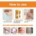 KCRPM Youth Bee Venom Psoriasis Treatment Cream - Soothing & Moisturizing Formula for All Skin Types | 1pcs - Buy Online on GoSupps.com