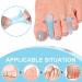 Gel Toe Separators - 10 Silicone Spacers for Overlapping Toes Bunion Corrector & Hammer Toe Straightener for Men & Women - Soft Flared Design - Buy Online on GoSupps.com