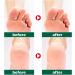 Urea Foot Cream Ultra Moisturizing 42% Urea Cream Heel Balm for Callus Removal and Soften Cracked Heel Repair Cream For Feet and Hand Maximum Strength for Hand Foot and Body Care - 100g - Buy Online on GoSupps.com