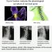 Neck Support & Pain Relief Tool | Cervical Traction Bandage for Recovery & Protection - Buy Online on GoSupps.com