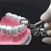 Maskis Interproximal Tooth Enamel Reduction Kit | Orthodontic Stripping for Interproximal Melting | International Shipping Available - Buy Online on GoSupps.com