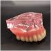 Vinbcorw Dental Model - Maxilla Mini 4 Implant Screws for Mobile Prosthesis Repairs | Removable Pink Design - Buy Online on GoSupps.com
