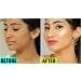 5in1 facial serum antiaging facial serum with vitamin C hyaluronic acid vitamin E brightening serum for dark spots even skin tone eye area fine lines and wrinkles 30 ml - Buy Online on GoSupps.com