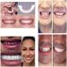 Giural Fake Teeth - Snap-On Veneers for a Perfect Smile | International Shipping Available - Buy Online on GoSupps.com