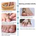 Ingrown Toenail Corrector & Lifter - Professional Toe Clamp for Effective Treatment - Buy Online on GoSupps.com