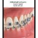 Dental Model Dentist Orthodontic Teeth Demonstration Model Orthodontic Dental Model with Ceramic Brackets and Metal Bracket for Learning Teaching Research - Buy Online on GoSupps.com