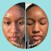 ZitSticka Blur Potion: Vitamin Supplement for Hyperpigmentation, Melasma & Dark Spots - 30 Caps - Buy Online on GoSupps.com