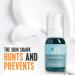 The Skin Shark Breakout Clearing Serum (50ml) - Hydrating Facial Serum With 5Beta-Scymnol For Blemish Prone Skin - Controls Facial Skin Oils that may be the cause of Acne - Suitable For Sensitive Skin - Buy Online on GoSupps.com