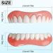 Buy High-Quality False Teeth Veneers | Cosmetic Tooth Covers & Provisional Dentures for a Perfect Smile - Buy Online on GoSupps.com