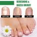 Fungal Nail Treatment For Toenails - Extra Strong Nail Fungus Treatment For Anti Fungal Nail Treatment - Fungal Nail Polish For Fix & Renew Damaged Broken Nails - Buy Online on GoSupps.com