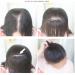 25 cm Real Hair Clip-In Hairpiece for Thinning Hair | Lightweight & Natural Look - Buy Online on GoSupps.com
