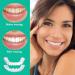 Frenzy 2 Couples Snap-On Dentures | Cosmetic Veneers for Men & Women | Dental Prosthesis with Tweezers - Buy Online on GoSupps.com