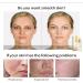 24K Mucin Snail Essence Snail Mucin Serum Face Moisturiser with Hyaluronic Acid Serum Niacinamide Serum Ginseng Extract Skincare for Hydrating Anti-Wrinkle Even Skin Tone - Buy Online on GoSupps.com
