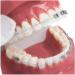 Dental Teeth Model - Orthodontic Study Tool with Metal & Ceramic for Demonstration - Buy Online on GoSupps.com