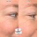 CLEARstem BRIGHTEYES Nourishing Eye Gel with Collagen Peptides & Aloe 0.7oz - Buy Online on GoSupps.com