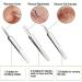 Blackhead Remover Tool Kit - FEITA Acne Pimple Tweezers Comedone Extractor Blemish Removal Tool Set for Facial Whitehead Popping Zit Removing - Buy Online on GoSupps.com
