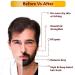 SODEN Advanced Beard Growth Oil - 2 x 30 ml | Stimulate Root & Follicle for Thicker Beards - Buy Online on GoSupps.com