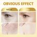 Bee Venom Skin Treatment Cream Natural Bee Venom Cream Promote Skin Restoration Improve and Fade Facial Blemishes Sensitive Skin Care Firm and Brighten Moisturizer - Buy Online on GoSupps.com